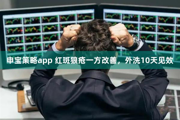 申宝策略app 红斑狼疮一方改善,外洗10天见效